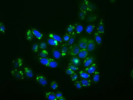 MAPK11 Antibody in Immunocytochemistry (ICC/IF)