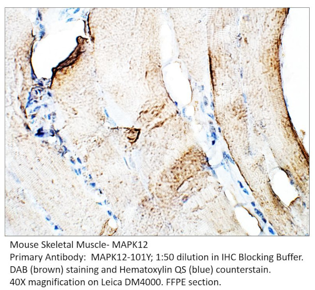 MAPK12 Antibody in Immunohistochemistry (IHC)