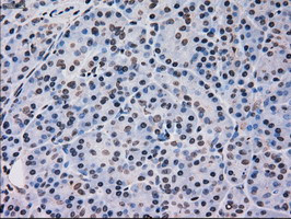 MAPK12 Antibody in Immunohistochemistry (Paraffin) (IHC (P))