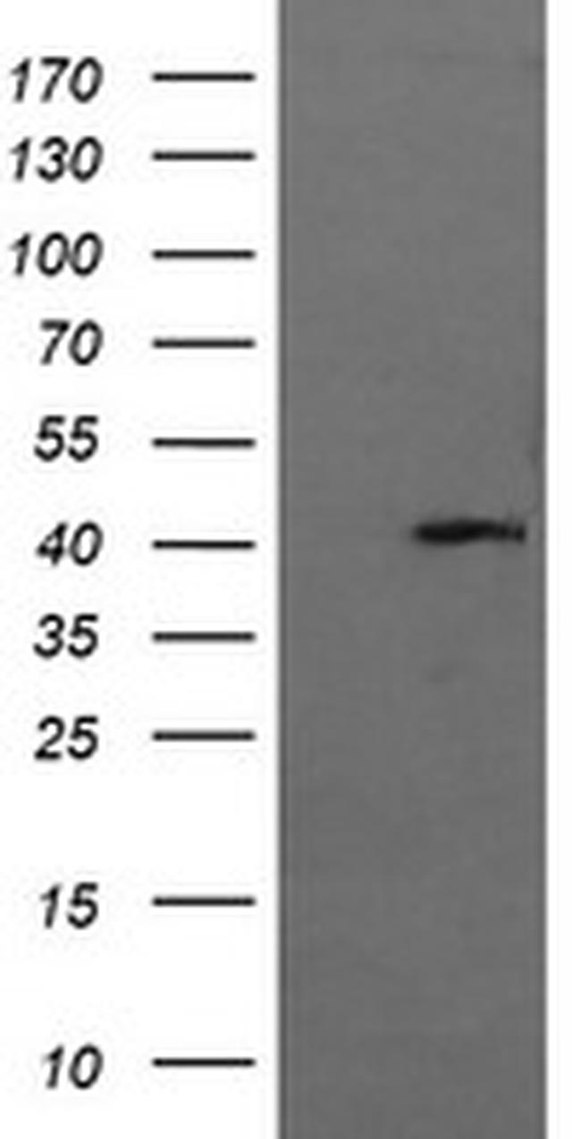 MAPK13 Antibody in Western Blot (WB)