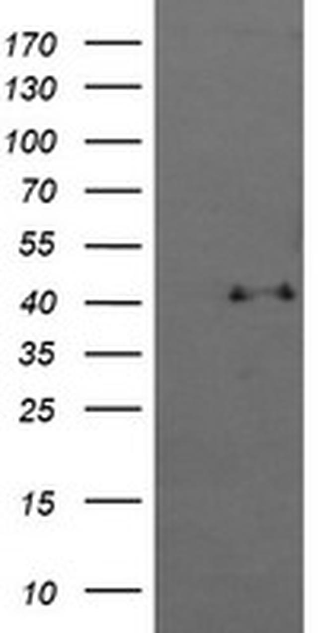 MAPK13 Antibody in Western Blot (WB)