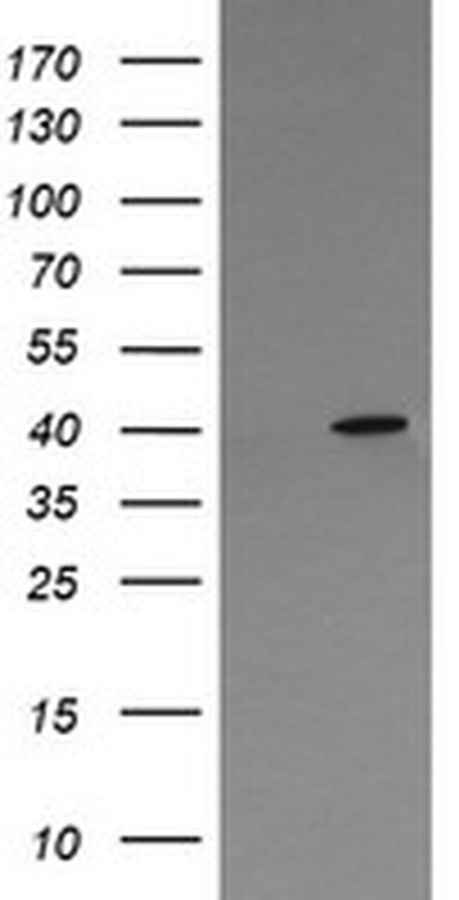 MAPK13 Antibody in Western Blot (WB)