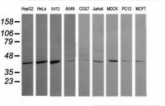 MAPK13 Antibody in Western Blot (WB)