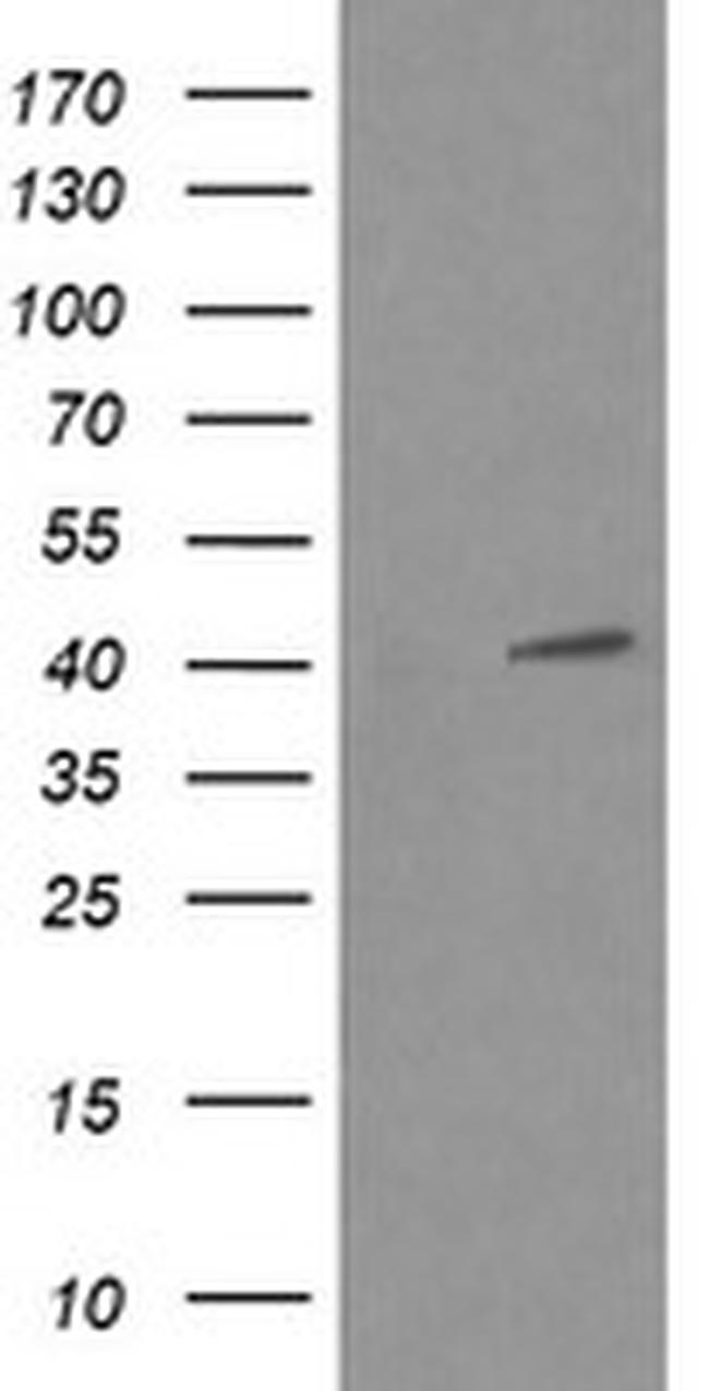 MAPK13 Antibody in Western Blot (WB)