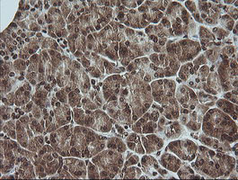 MAPK3 Antibody in Immunohistochemistry (Paraffin) (IHC (P))