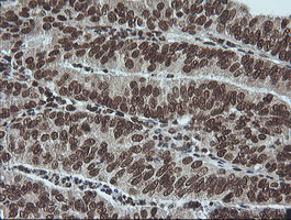 MAPK3 Antibody in Immunohistochemistry (Paraffin) (IHC (P))