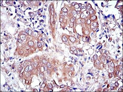 ERK1 Antibody in Immunohistochemistry (Paraffin) (IHC (P))