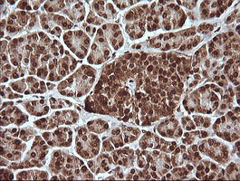 MAPK4 Antibody in Immunohistochemistry (Paraffin) (IHC (P))