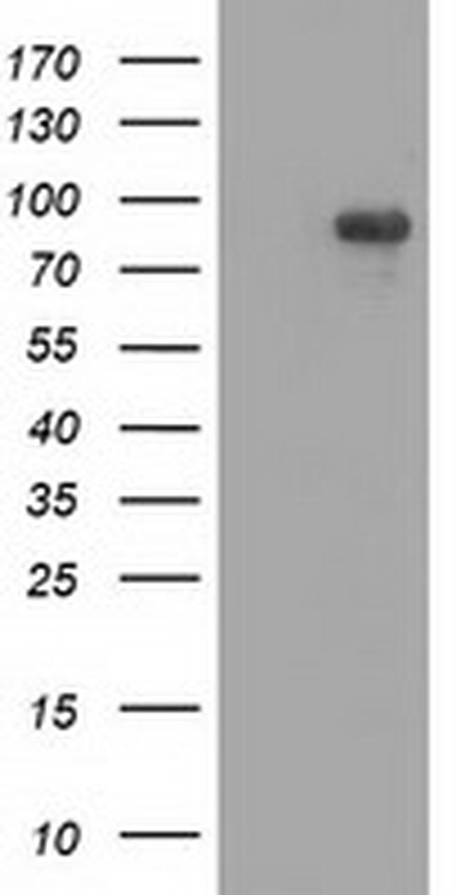 MAPK7 Antibody in Western Blot (WB)