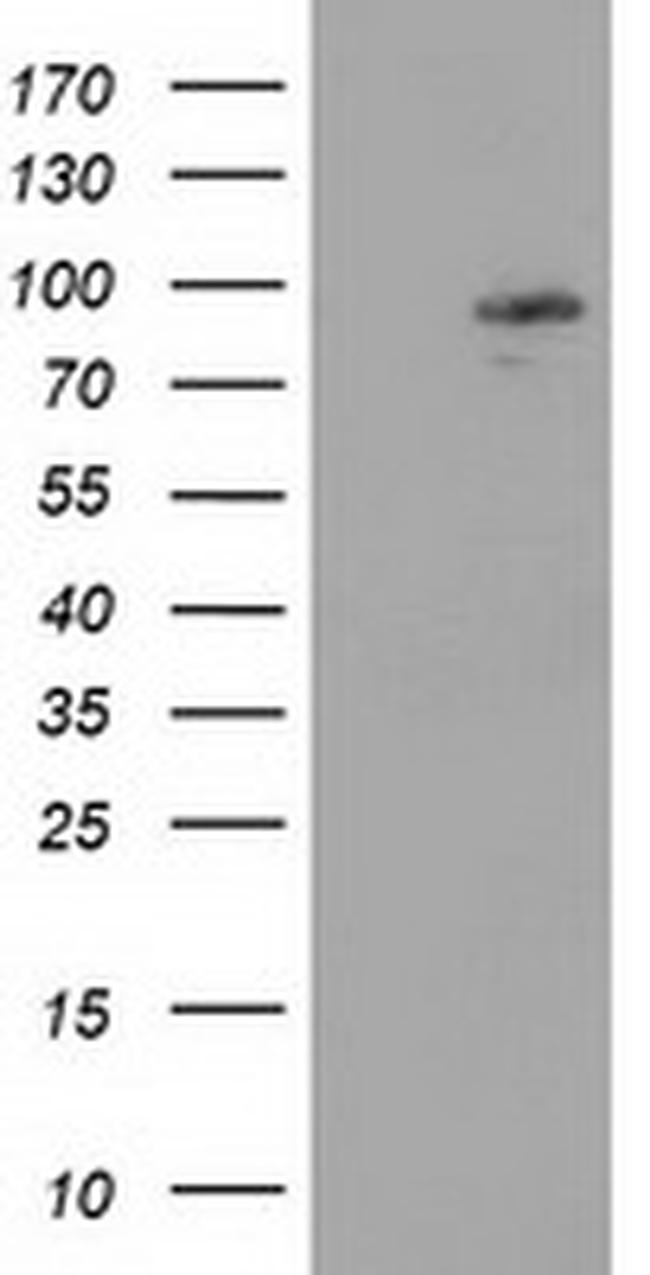 MAPK7 Antibody in Western Blot (WB)