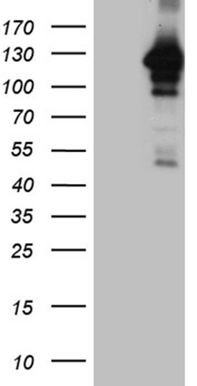 MAPK8IP1 Antibody in Western Blot (WB)