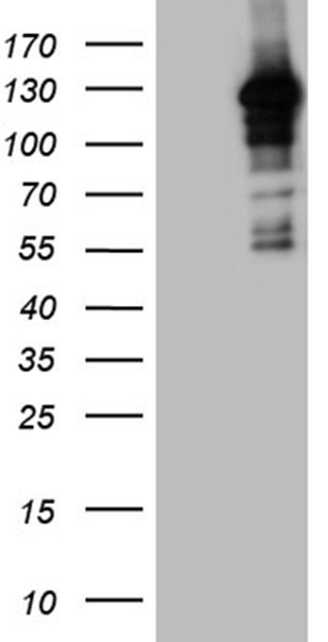 MAPK8IP1 Antibody in Western Blot (WB)