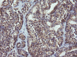 MAPK9 Antibody in Immunohistochemistry (Paraffin) (IHC (P))