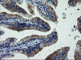 MAPK9 Antibody in Immunohistochemistry (Paraffin) (IHC (P))