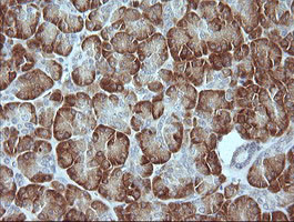 MAPK9 Antibody in Immunohistochemistry (Paraffin) (IHC (P))