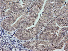 MAPK9 Antibody in Immunohistochemistry (Paraffin) (IHC (P))