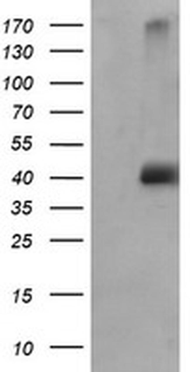 MAPK9 Antibody in Western Blot (WB)