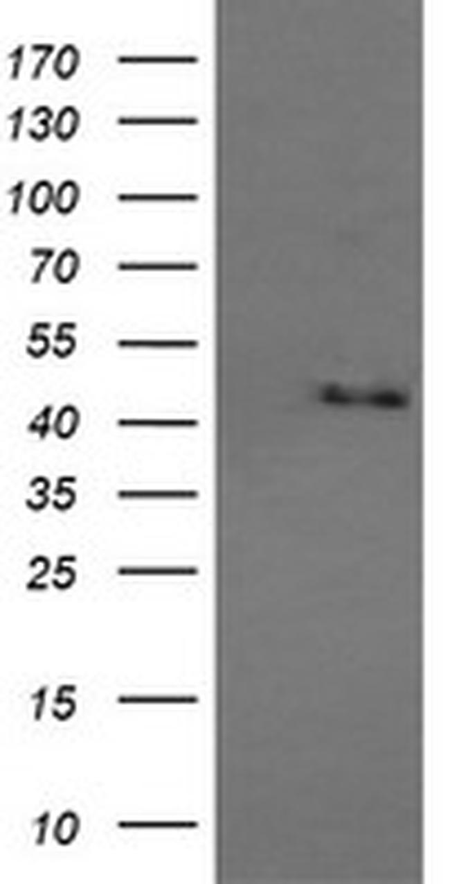 MAPK9 Antibody in Western Blot (WB)