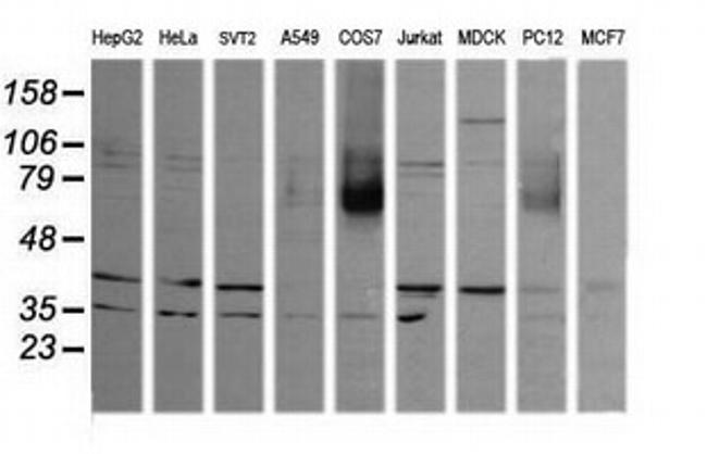 MAPK9 Antibody in Western Blot (WB)