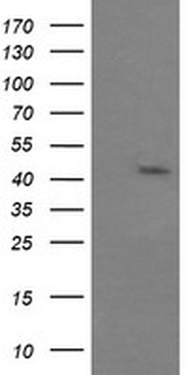 MAPK9 Antibody in Western Blot (WB)