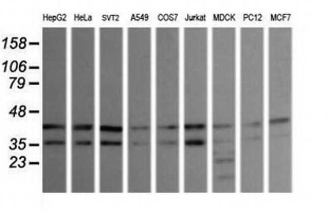 MAPK9 Antibody in Western Blot (WB)