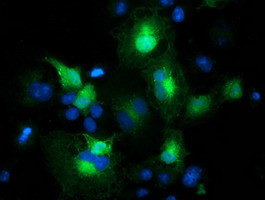 EB2 (MAPRE2) Antibody in Immunocytochemistry (ICC/IF)