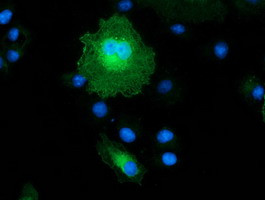 EB2 (MAPRE2) Antibody in Immunocytochemistry (ICC/IF)