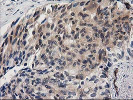 EB2 (MAPRE2) Antibody in Immunohistochemistry (Paraffin) (IHC (P))