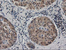 EB2 (MAPRE2) Antibody in Immunohistochemistry (Paraffin) (IHC (P))