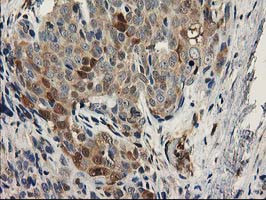 EB2 (MAPRE2) Antibody in Immunohistochemistry (Paraffin) (IHC (P))