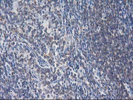 EB2 (MAPRE2) Antibody in Immunohistochemistry (Paraffin) (IHC (P))