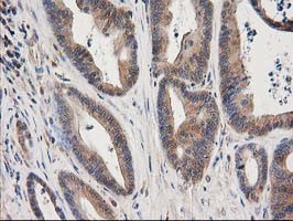 EB2 (MAPRE2) Antibody in Immunohistochemistry (Paraffin) (IHC (P))