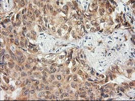 EB2 (MAPRE2) Antibody in Immunohistochemistry (Paraffin) (IHC (P))