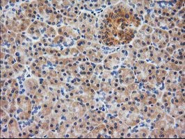 EB2 (MAPRE2) Antibody in Immunohistochemistry (Paraffin) (IHC (P))