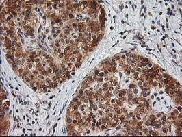 EB2 (MAPRE2) Antibody in Immunohistochemistry (Paraffin) (IHC (P))