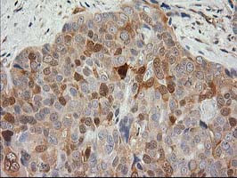 EB2 (MAPRE2) Antibody in Immunohistochemistry (Paraffin) (IHC (P))