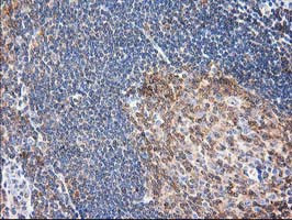 EB2 (MAPRE2) Antibody in Immunohistochemistry (Paraffin) (IHC (P))