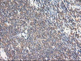 EB2 (MAPRE2) Antibody in Immunohistochemistry (Paraffin) (IHC (P))