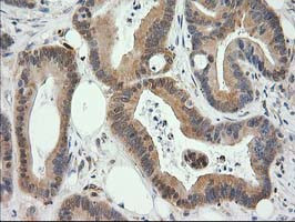 EB2 (MAPRE2) Antibody in Immunohistochemistry (Paraffin) (IHC (P))