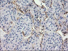 EB2 (MAPRE2) Antibody in Immunohistochemistry (Paraffin) (IHC (P))