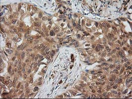 EB2 (MAPRE2) Antibody in Immunohistochemistry (Paraffin) (IHC (P))