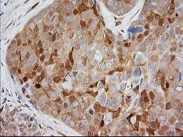 EB2 (MAPRE2) Antibody in Immunohistochemistry (Paraffin) (IHC (P))