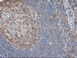 EB2 (MAPRE2) Antibody in Immunohistochemistry (Paraffin) (IHC (P))