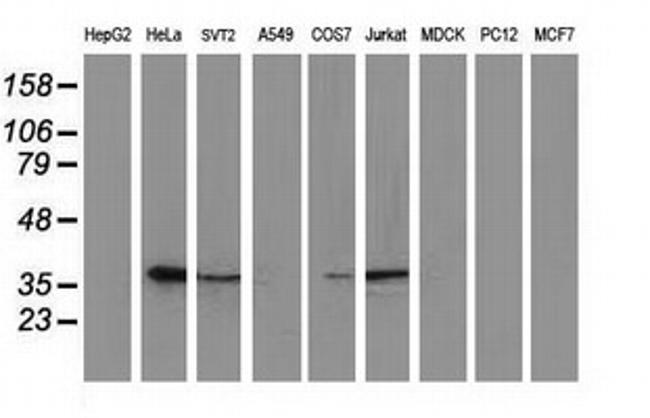 EB2 (MAPRE2) Antibody in Western Blot (WB)