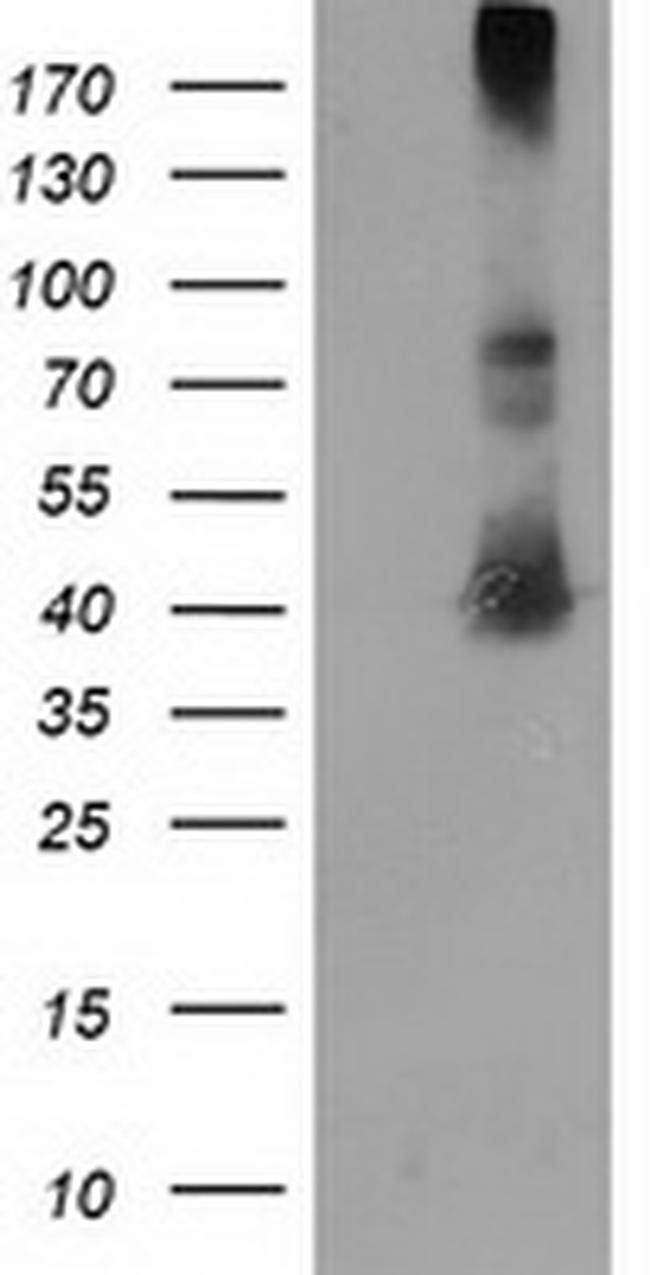 EB2 (MAPRE2) Antibody in Western Blot (WB)