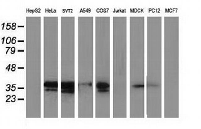 EB2 (MAPRE2) Antibody in Western Blot (WB)