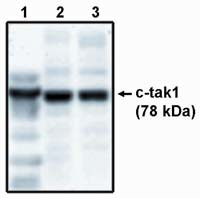 MARK3 Antibody in Western Blot (WB)