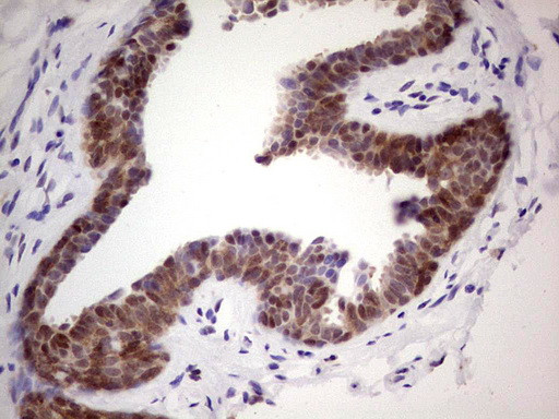 MARK3 Antibody in Immunohistochemistry (Paraffin) (IHC (P))