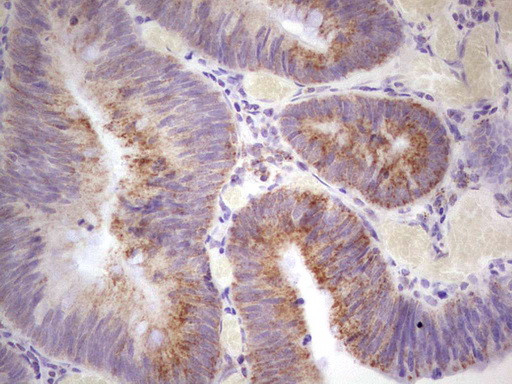 MARK3 Antibody in Immunohistochemistry (Paraffin) (IHC (P))