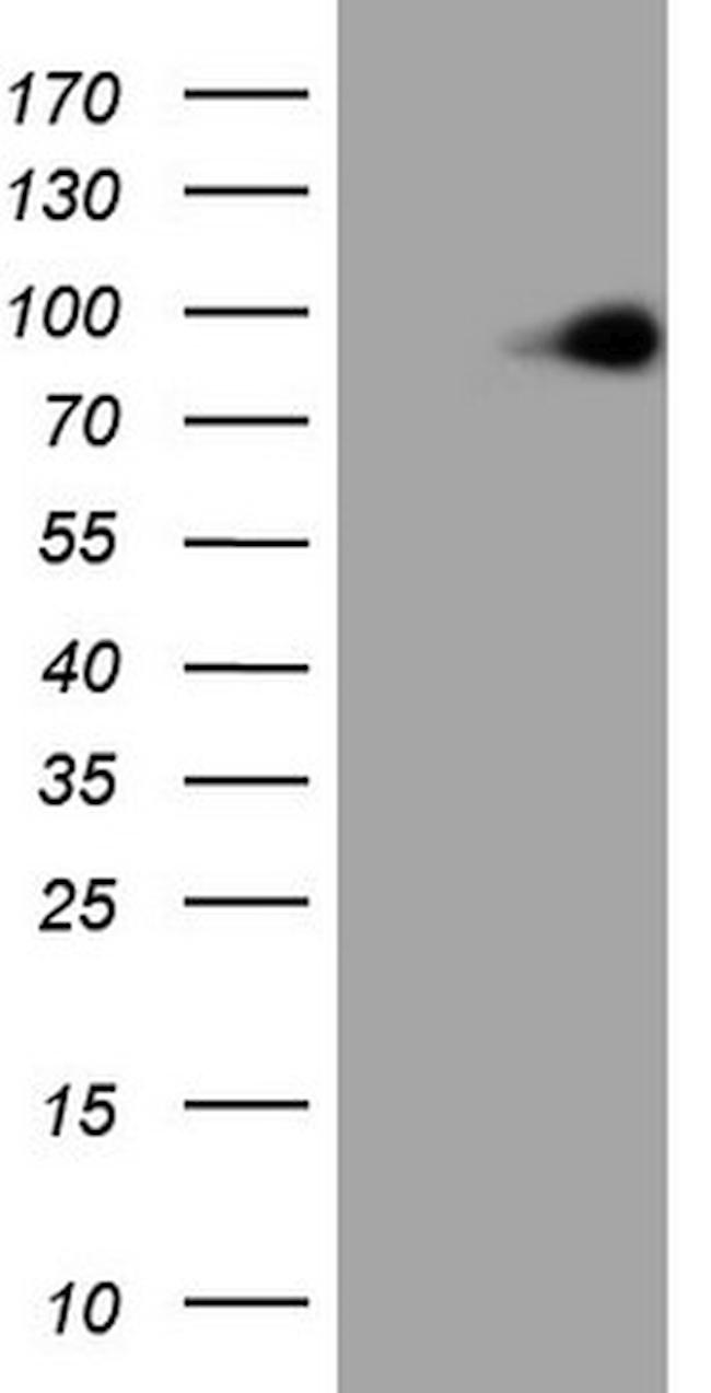 MARK3 Antibody in Western Blot (WB)